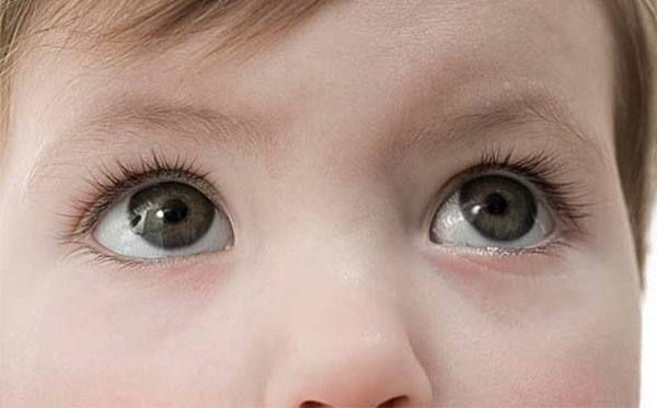 眼屎多是什么原因 眼屎多需要看医生吗